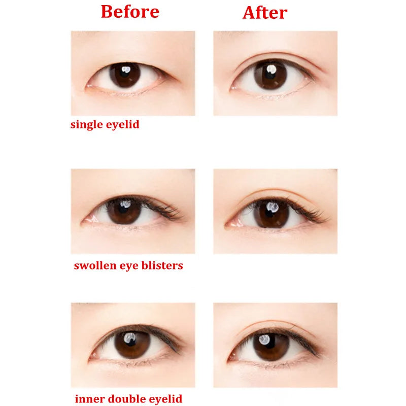 U N N Y Eyelid Tape Sticker Invisible Double Fold Eyelid Paste Beige Stripe Self-adhesive Natural Eye Tape Makeup Tool